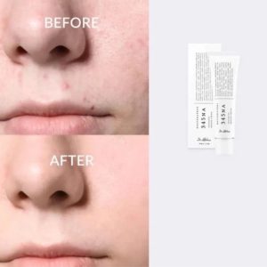 خرید کرم ترمیم کننده دکتر آلتیا 345 (Dr. Althea 345 Relief Cream)