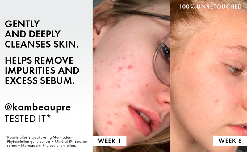 آبرسان ضد جوش ویشی مدل NORMADREM PHYTOSOLUTION