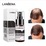 محلول تقویت کننده مو لنبنا مدل ESSENCE GROWTH حجم 20 میلی لیتر