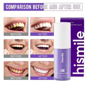 سرم سفیدکننده فوری دندان های اسمایل Hismile V34